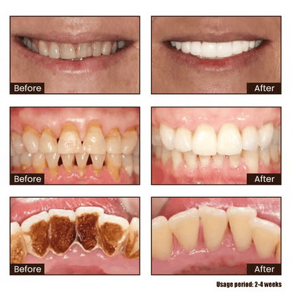 New 7-Pro Intensive Toothpaste | Upgraded Purple Formula with 7 Probiotics | Deep Enamel Repair & Long-Lasting Freshness